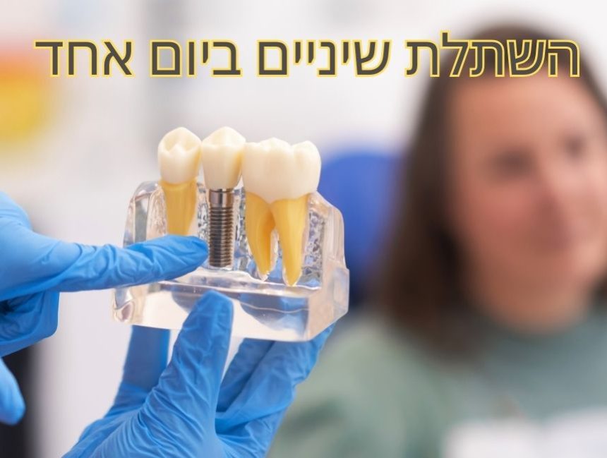 מה זה השתלת שיניים ביום אחד ?