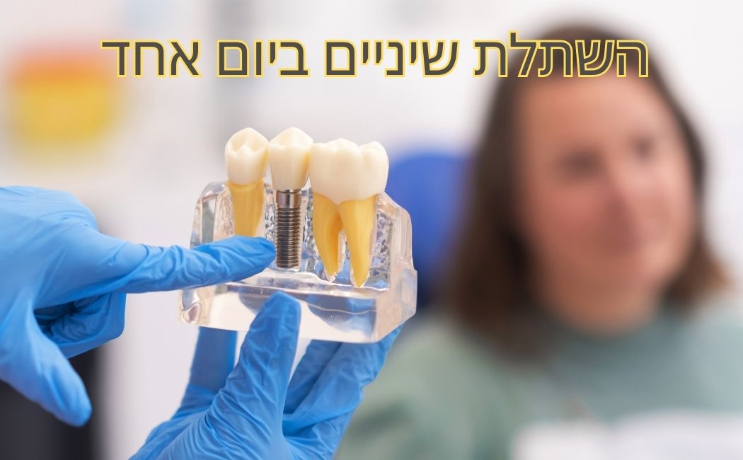 מה זה השתלת שיניים ביום אחד ?