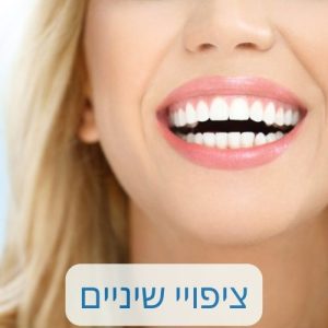 ציפויי שיניים בראשון לציון